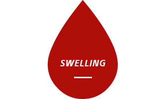 Schwellung